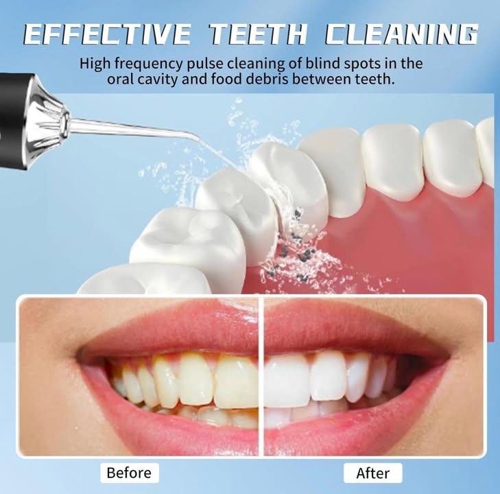 Yunlism 無線充電水牙線機 (6)